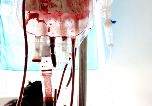 a unit of blood on an IV pole